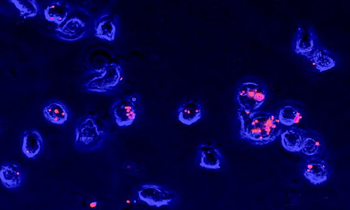 Attacking Weaknesses in Killer Bacteria with Help from Glowing Beads