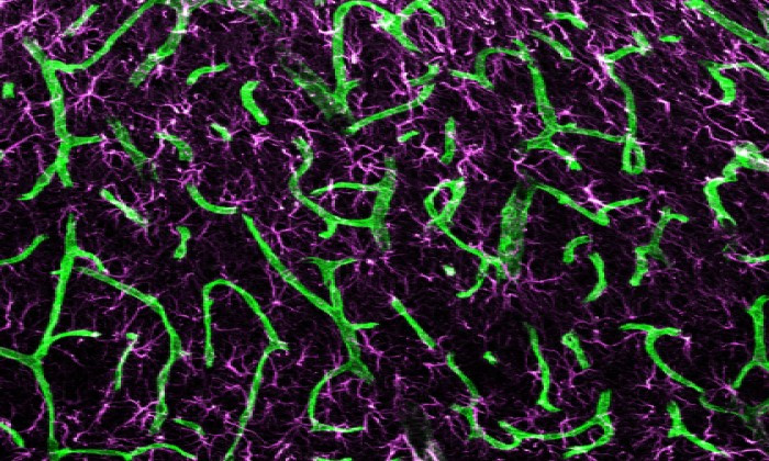 Discovery about Brain Cells that Promote Healing from Strokes Offers Treatment Insights