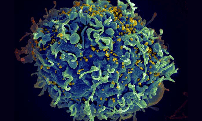 HIV Hidden in Patients’ Cells Can Now Be Accurately Measured